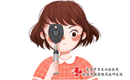 儿童牛皮癣能治好吗?参地肤康丸中药吗