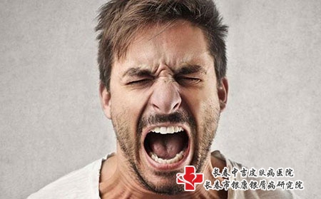 哪些人更容易吸引银屑病？