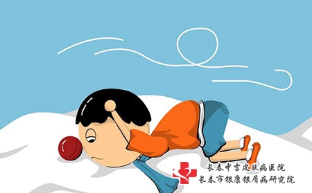 孩子患有牛皮癣怎么护理？