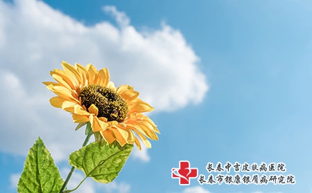 新冠疫情期间，患了牛皮癣要注意什么