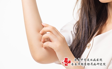 双臂对称长棕红色斑块该怎么治