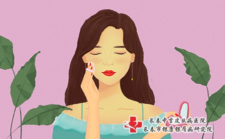 女性牛皮癣患者吃什么有利于病情