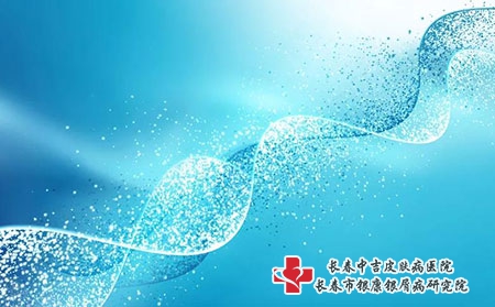 牛皮癣的日常护理常识你知道哪些