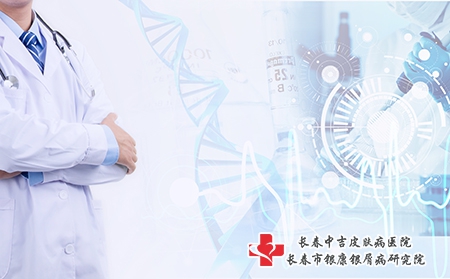 得了寻常型牛皮癣该怎么治疗