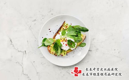 妇女牛皮癣预防需要做到哪几点呢?