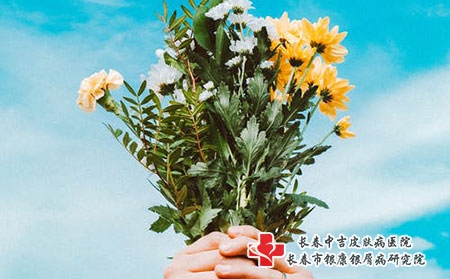 男人患上牛皮癣如何通过饮食预防复发?