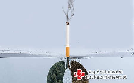 长春银屑病医院第35个世界无烟日银屑病患者戒烟很重要