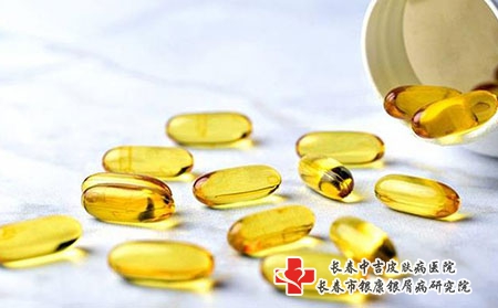 牛皮癣怎么治疗会比较好?长春牛皮癣医院地址?
