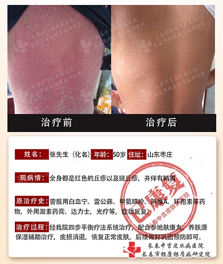 10月1日-7日长春银康医院举行“庆国庆筑梦皮肤健康·多专家联合会诊公益活动”