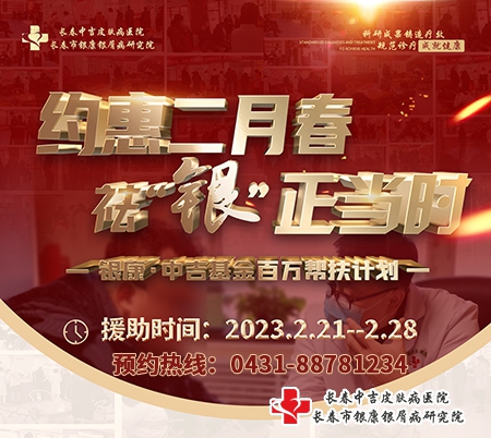 长春银康银屑病医院2月春季牛皮癣治疗优惠活动