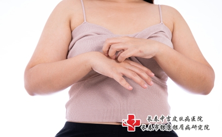 摄图网_325528319_女性在抓手时孤立的白种背景 医疗 为广告概念提供保健服务病人医生病变治疗伤口皮炎过敏皮肤皮肤科表皮（企业商用）