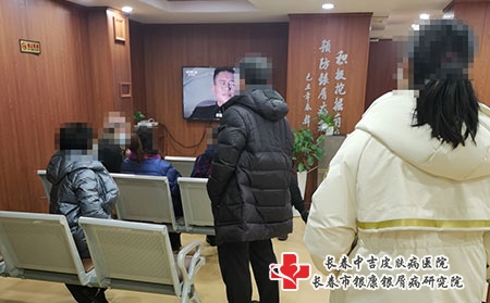 长春哪里治牛皮癣-长春银屑病医院治疗价位