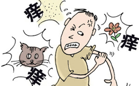 红皮型银屑病的症状有什么