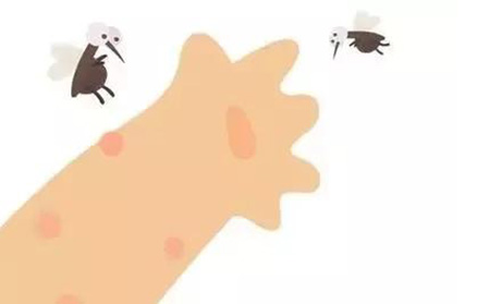 银屑病应该怎么进行护理
