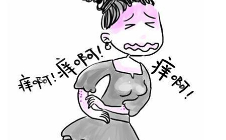 女性出现银屑病的原因有什么