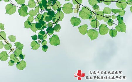 牛皮癣能治好吗?