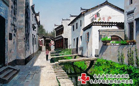 长春巿哪里治银屑病好?银屑病这些特点需要注意