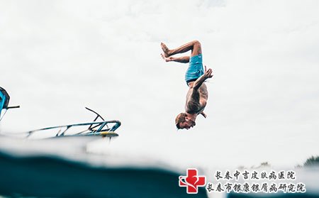 长春治银屑病的方法是什么
