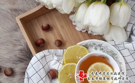 银屑病沐浴能用硫磺皂吗