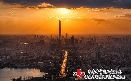 长春银康医院讲牛皮癣的危害