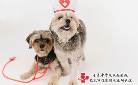儿童怎么得牛皮癣的
