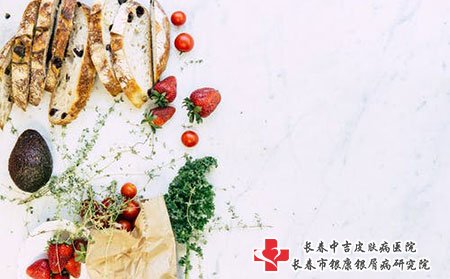 皮肤开始瘙痒掉屑是银屑病吗