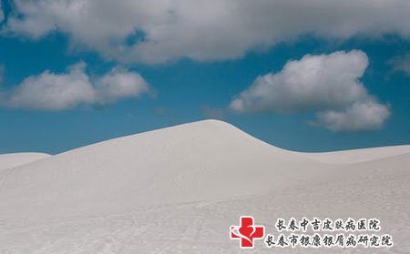 银屑病症状多久能消退，预防复发的方法