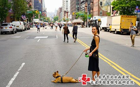 患上银屑病会有哪些症状