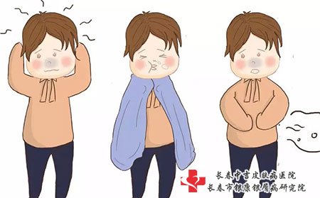服用哪些维生素有助于银屑病的治疗
