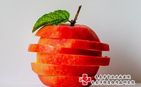 长春银康银屑病研究院讲三七粉对牛皮廨有用吗