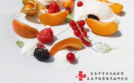 长春看牛皮癣的医院哪家好