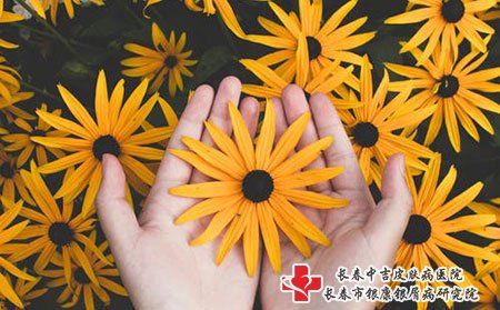 喝酒会不会加重银屑病
